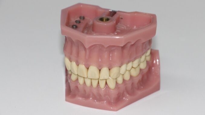 BridgeWork Teeth