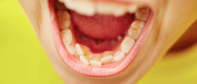 shark-teeth-children-630x270 Shark Teeth