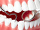 oral hygien